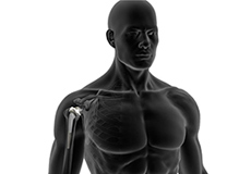 Reverse Shoulder Replacement